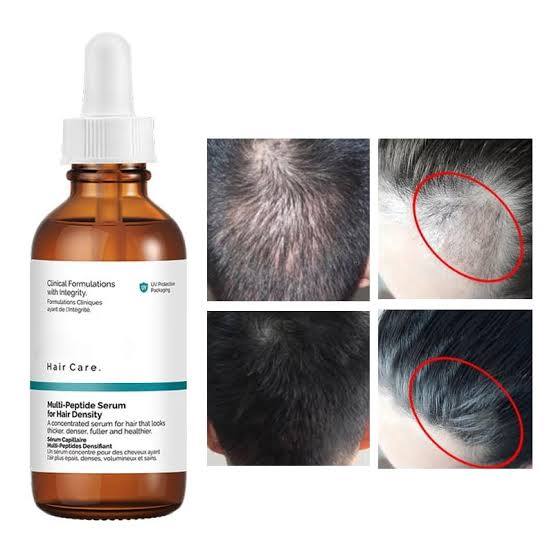 The Ordinary – Suero multipéptido para la densidad capilar 💁♀️ + Envío gratuito + Pago por recepción